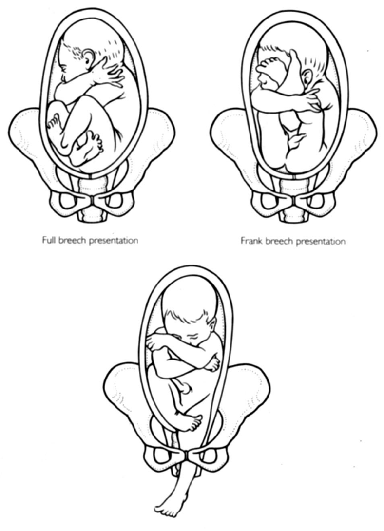 birthsamples